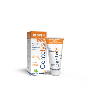 Centelys