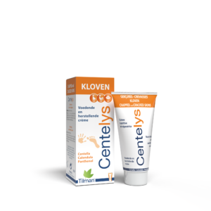 Centelys